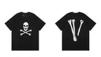 V TEE (1)